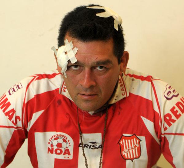 PUGIL MALTRATADO. Pucheta denunció que durante un partido lo golpeó el presidente del club San Martín. ARCHIVO LA GACETA / ANTONIO FERRONI 