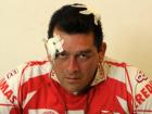 PUGIL MALTRATADO. Pucheta denunció que durante un partido lo golpeó el presidente del club San Martín. ARCHIVO LA GACETA / ANTONIO FERRONI 