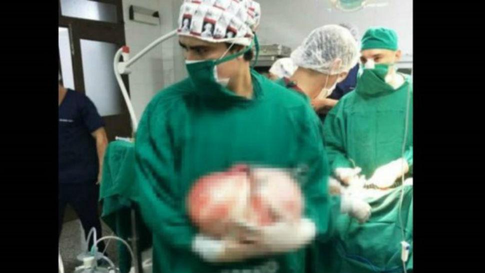 Le extirpan un tumor de 10 kilos a una abuela de 75 años Le extirpan un tumor de 10 kilos a una abuela de 75 años