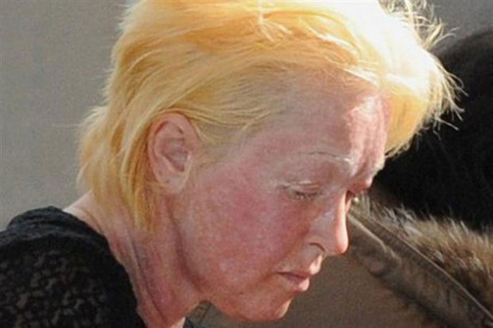 ¿Qué tiene Cindy Lauper en la cara?