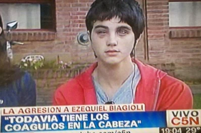 Indagan al rugbier tucumano por la golpiza a Biagioli