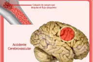 Si te lo proponés, podés volver a caminar, comer y vestirte