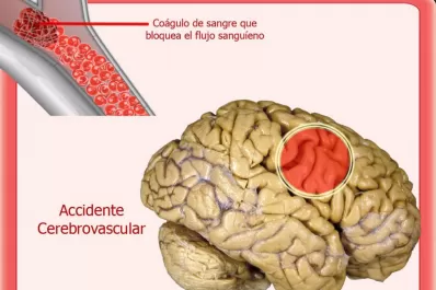 Si te lo proponés, podés volver a caminar, comer y vestirte