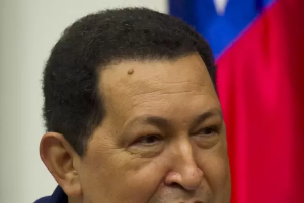 Chávez planea volver a su país al finalizar la radioterapia