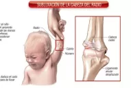 Cuidado con los tirones de la mano o de la muñeca: se puede dislocar el codo