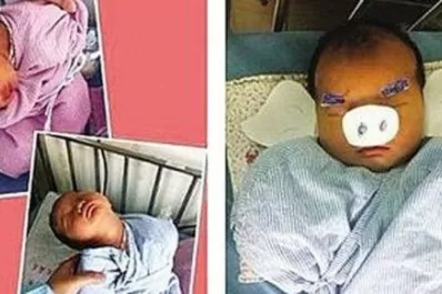 Despiden a enfermera que se burlaba de recién nacidos en las redes sociales