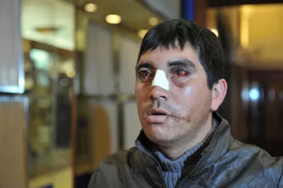 Un joven dice que un ex concejal lo chocó y después no lo ayudó