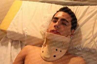 Desfiguran a golpes a un modelo en La Plata y acusan a rugbistas