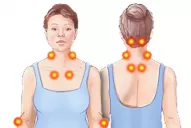 Fibromialgia: un mal que se esconde entre dolores difusos y punzantes