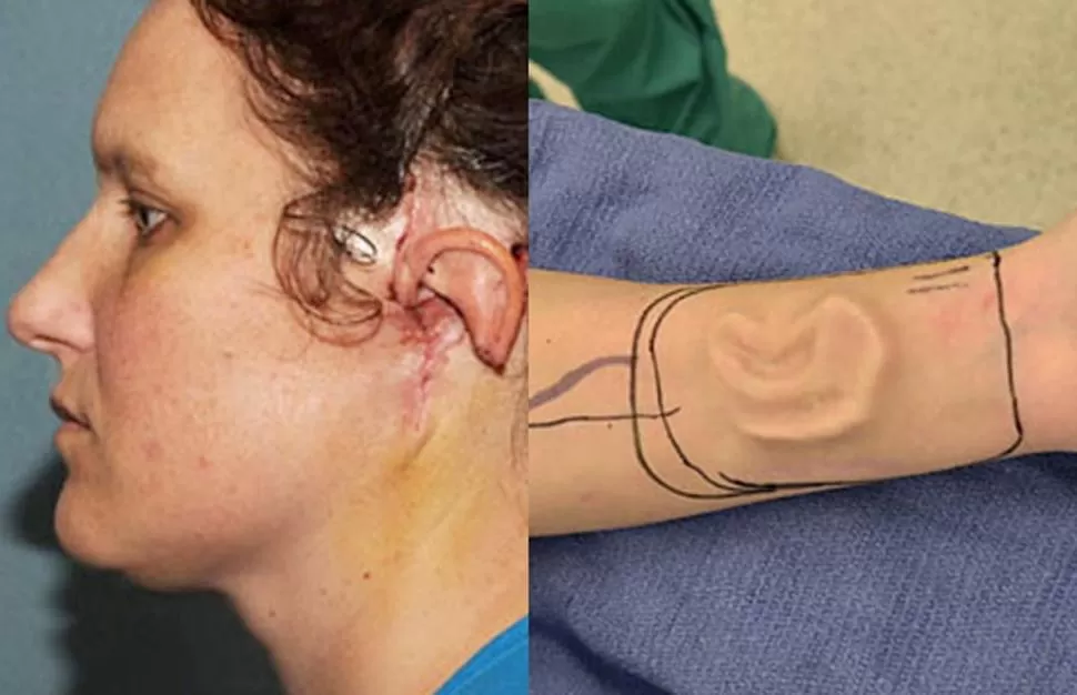SE ANIMO A LA CIRUGIA. Sherrie Walter se negaba a usar una prótesis en la oreja. FOTO TOMADA DE ABCNEWS.GO.COM