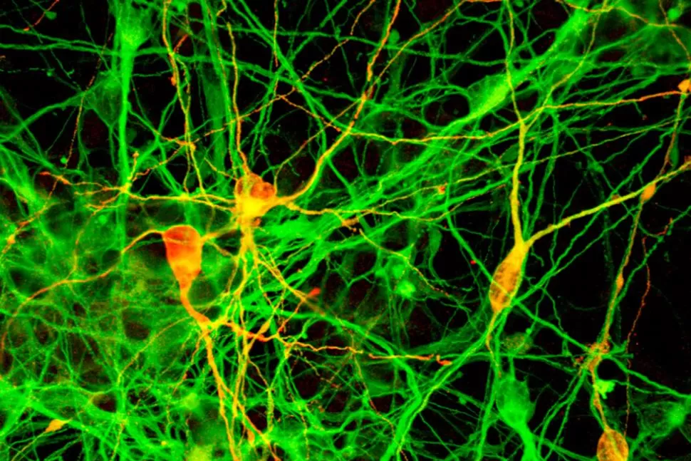 UN MUNDO POR DESCUBRIR. La imagen muestra neuronas de un estudio realizado por Yamanaka. REUTERS.