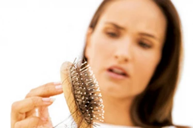 Cinco cosas que conviene saber sobre.... la pérdida de cabello