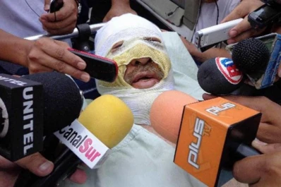 Quemaron a un periodista boliviano mientras estaba al aire en una radio
