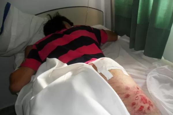 En Aguilares repudiaron la agresión recibida en Santiago