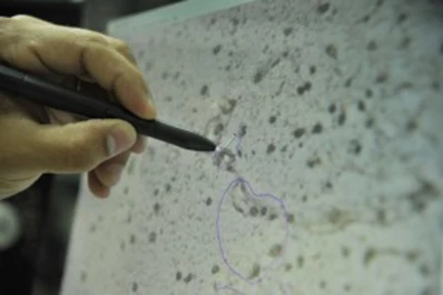 En el país no se usarán terapias con células madre cuya eficacia no esté comprobada