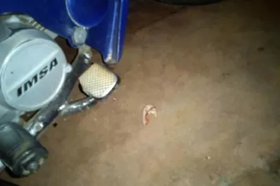 Un hombre le arrancó la oreja a otro durante una violenta discusión