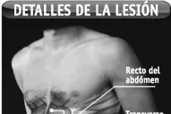 El mismo problema que no deja en paz a Nalbandian