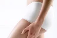 Celulitis: Ni las adolescentes se salvan