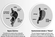 Cirugía bariátrica: no hay milagros sin cambio de vida