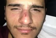 Golpean e insultan a una pareja gay invocando al  Papa