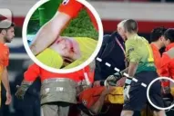 Así le quedó la rodilla a Mascherano