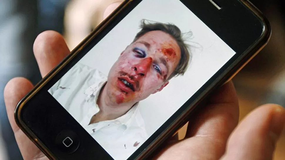 AGRESION. Así quedó el rostro de uno de los jóvenes agredidos. FOTO TOMADA DE MAILYDAIL.CO.UK