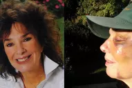 Graciela Borges mostró una impactante foto de su rostro