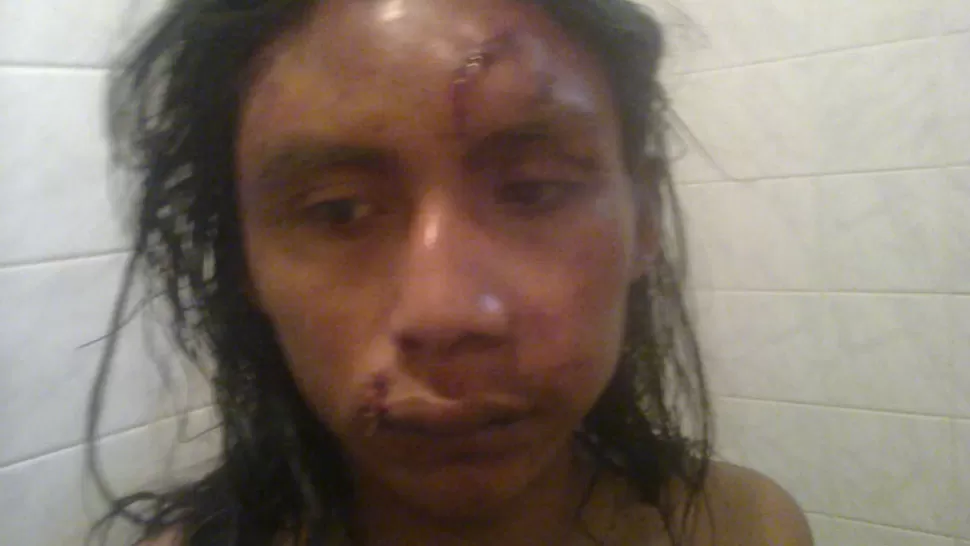 SALVAJE GOLPIZA. El hijo de cacique terminó con su rostro seriamente dañado. FOTO TOMADA DE AGENCIAWALSH.ORG