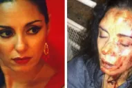 Una bailarina de flamenco recibió una brutal paliza