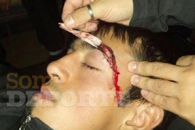 Santiago del Estero: Hinchas de Mitre agredieron a jugadores de Estudiantes de San Luis