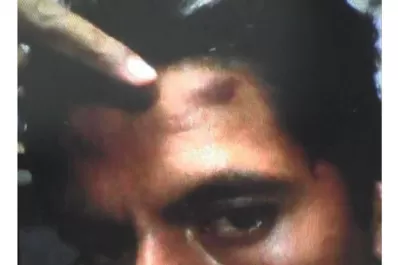 Salta: Un hombre acusa a policías de haberlo torturado