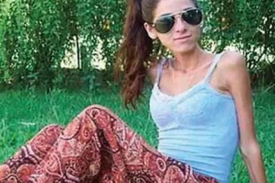 Padecía anorexia y murió  por negarse a recibir tratamiento por motivos religiosos