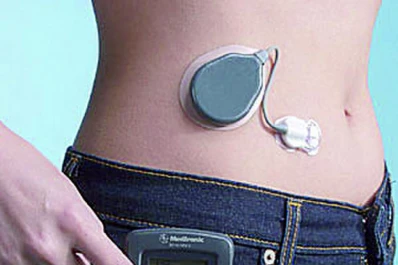 Una esperanza para millones de diabéticos