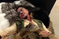 Ricardo Fort pone a Dios como excusa para usar pieles de animales