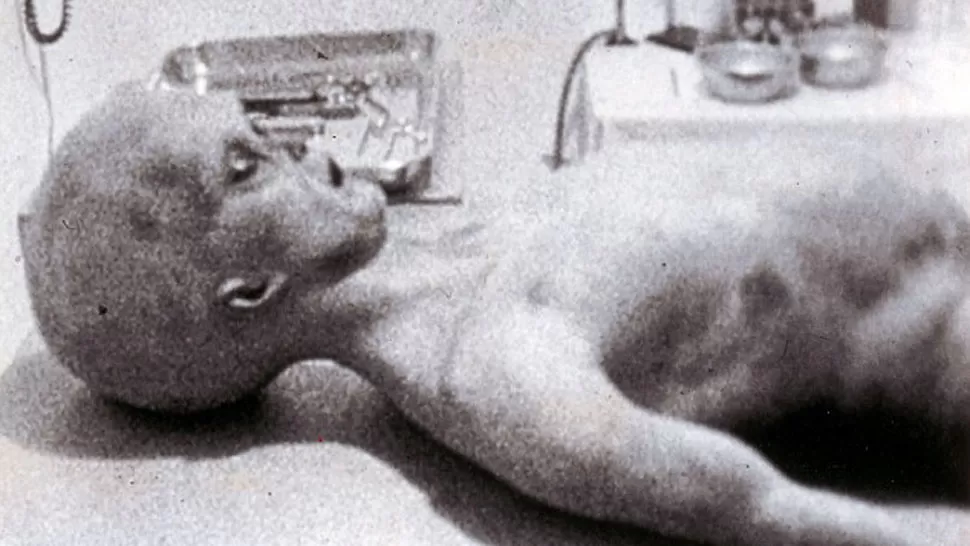 EMBLEMATICA. La imagen del supuesto extraterrestre encontrado en Roswell. FOTO TOMADA DE DAILYMAIL.CO.UK