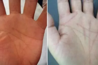 ¿Es posible cambiar el destino con cirugía?