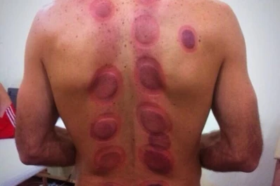 ¿Qué le pasó al “Flaco” Schiavi en la espalda?