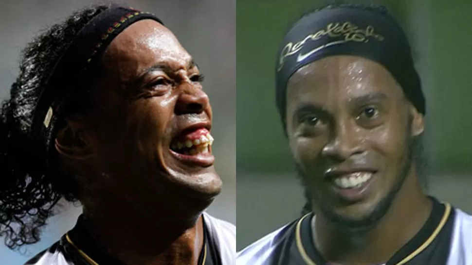 CAMBIO. Ronaldinho y sus dientes, antes y después. FOTOMONTAJE LA GACETA