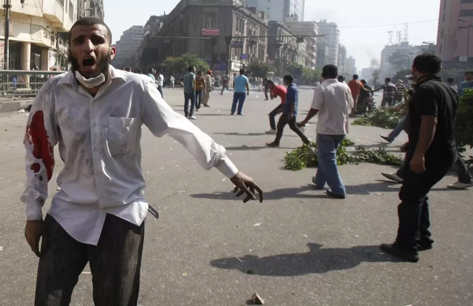 HERIDO DE BALA. Un partidario del depuesto presidente Mursi denuncia a la prensa la represión de la Policía. REUTERS