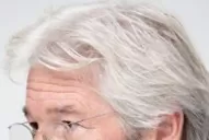 Un tratamiento hace desaparecer las canas para siempre