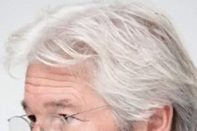 Un tratamiento hace desaparecer las canas para siempre