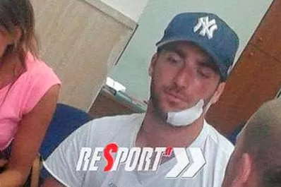 Higuaín sufrió un accidente en un barco y terminó con 10 puntos en la cara