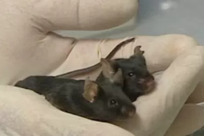 Prueban droga para curar el síndrome de Down en recién nacidos