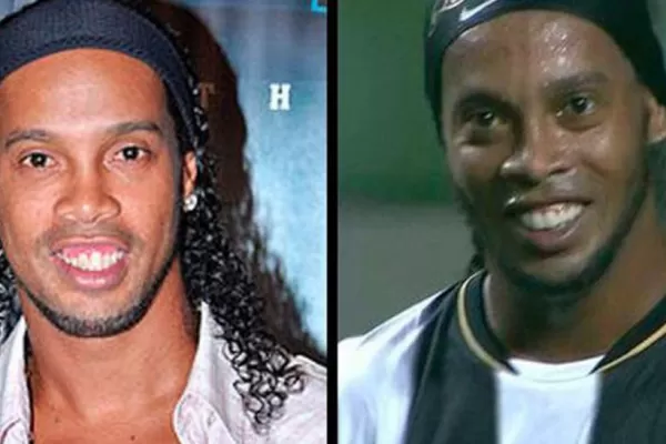 La nueva sonrisa de Ronaldinho costó €50 mil