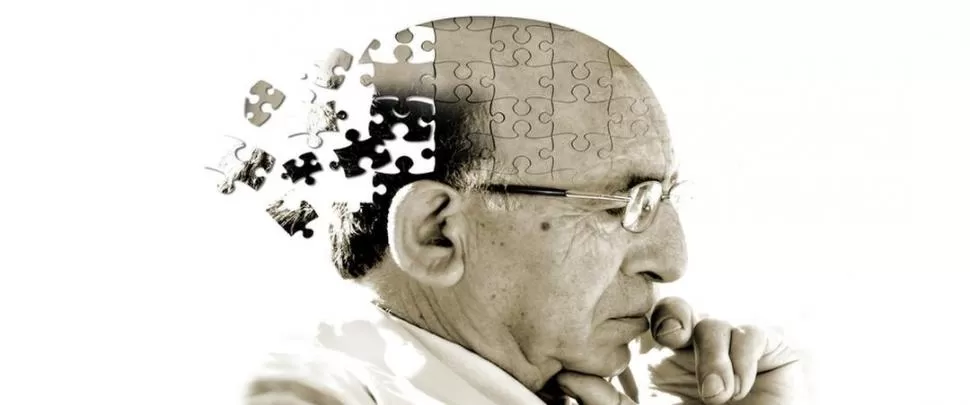 DETERIORO COGNITIVO. El factor de riesgo más importante para padecer el Alzheimer es la edad. 
