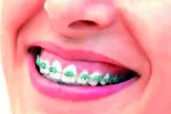 Dientes blancos y perfectos: nuevos objetos de deseo