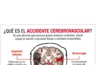 El ACV provoca 14.000 muertes al año en el país