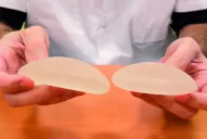 Unas 18.000 españolas deberán sacarse la prótesis mamaria PIP