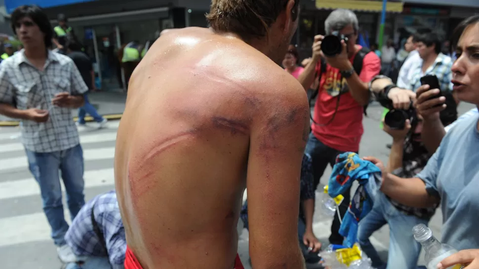 A LOS PALOS. Las huellas de la represión en la espalda de un manifestante. LA GACETA / FOTO DE FRANCO VERA
