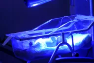 Esmeralda: La bebé de 37 cm que derrotó la muerte